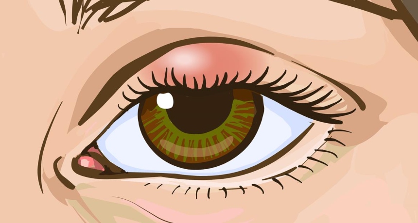 Причини за отечени очни капаци