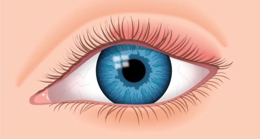 Отечени очни капаци: 10 главни причини и кои симптоми бараат итна лекарска помош