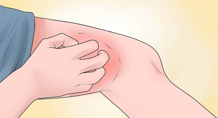 Инфекција на кожата: Најдобрите домашни третмани и кога да посетите лекар