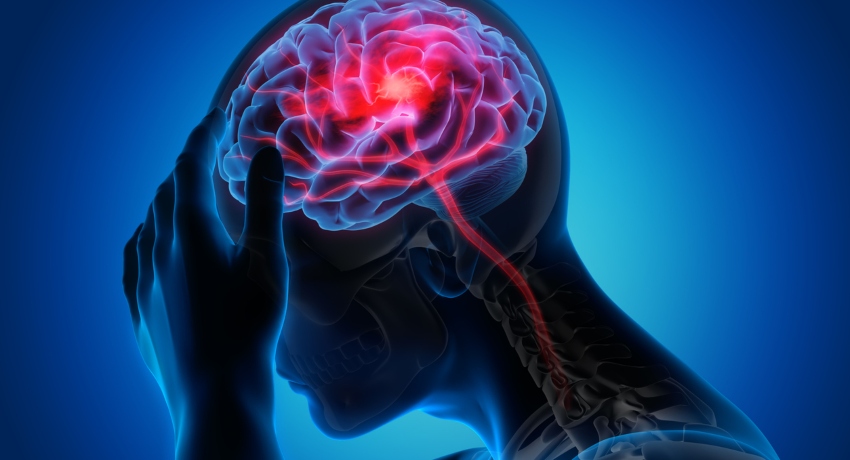 5-те сигнали кои телото ги испраќа до нас неколку дена пред мозочен удар