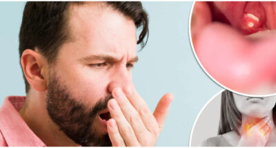4 причини поради кои може да имате лош здив, дури и по четкање на забите